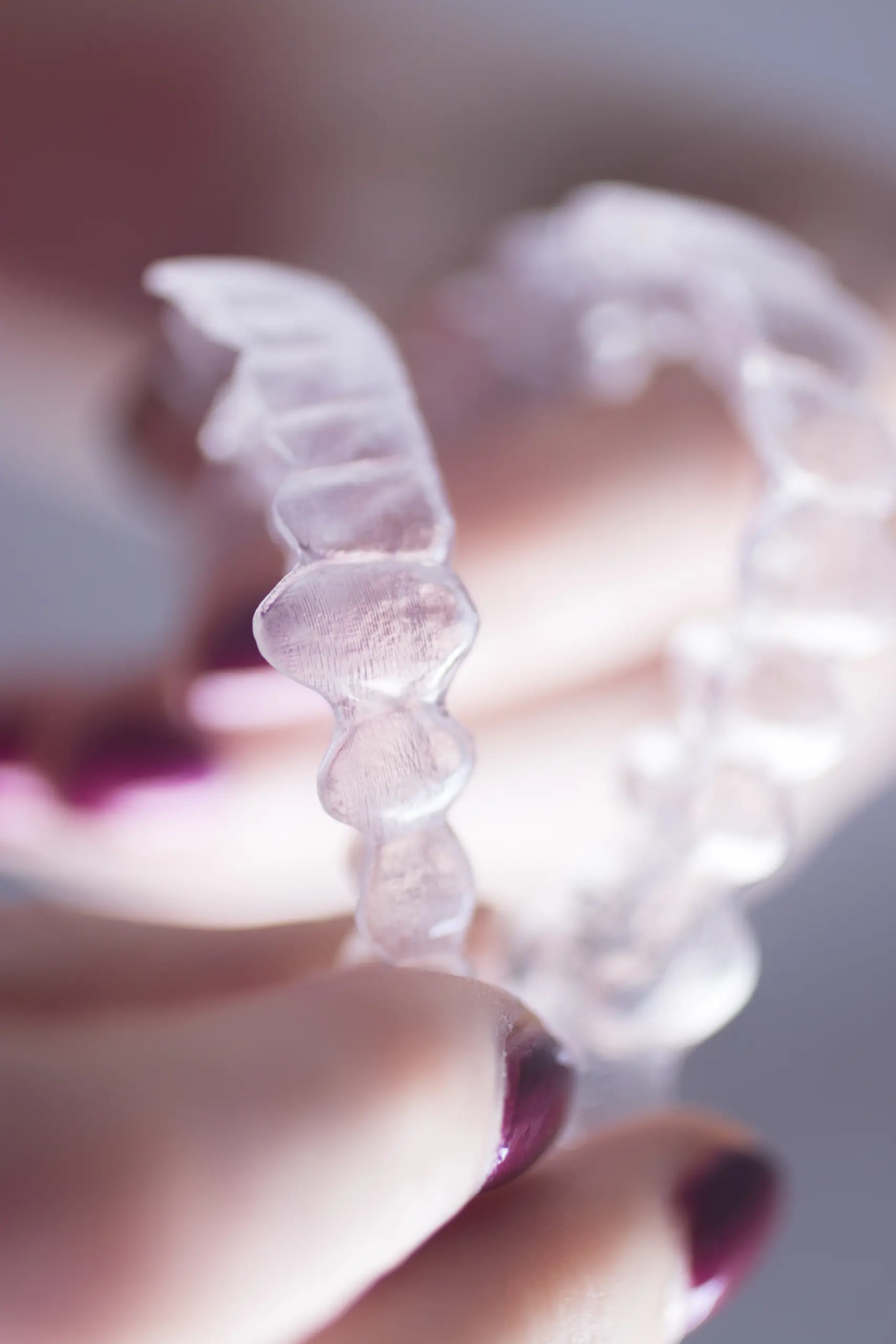 allineatori trasparenti dentista lecco clinica san martino