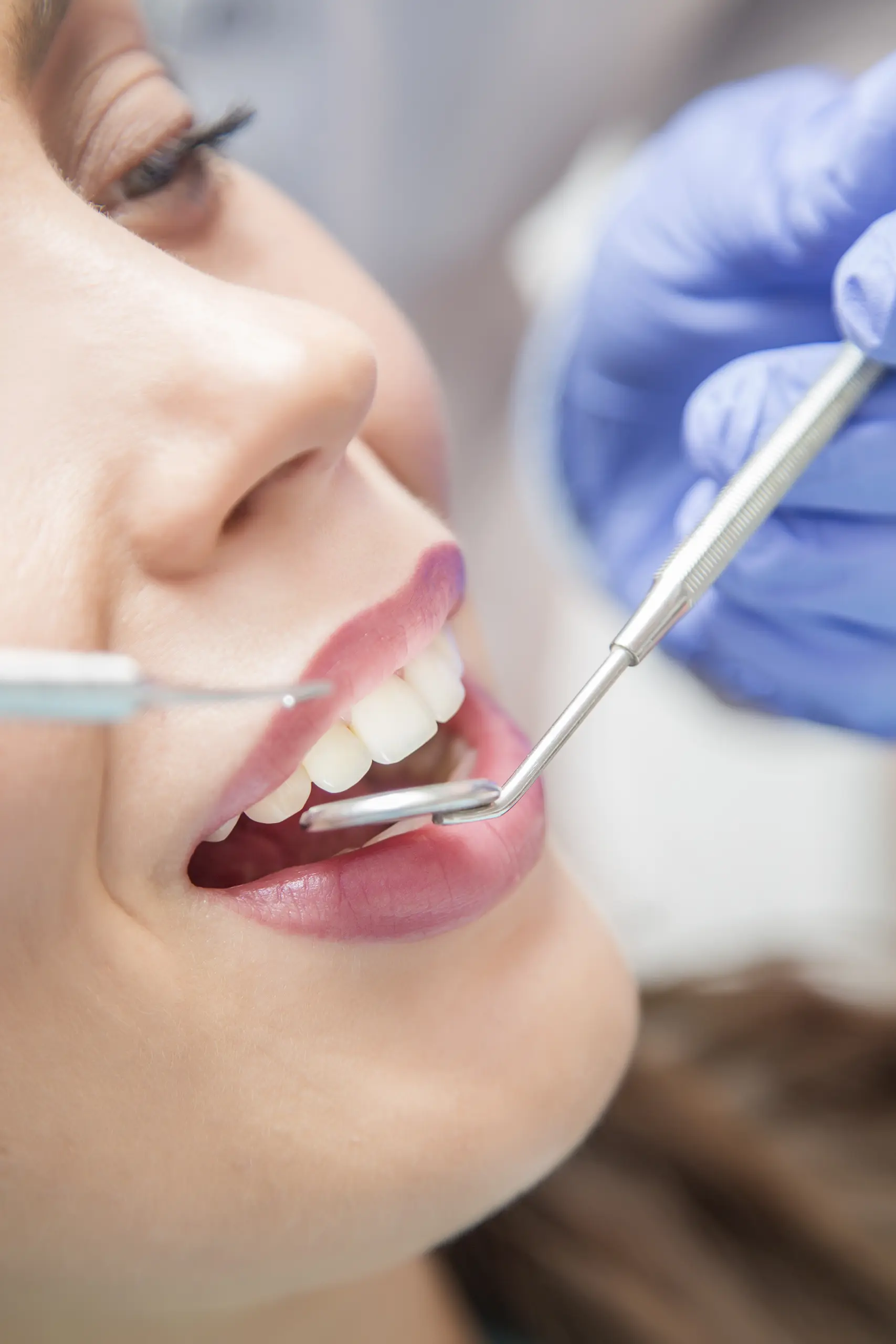 parodontite dentista lecco