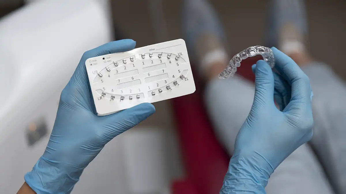 allineatori trasparenti dentista lecco clinica san martino