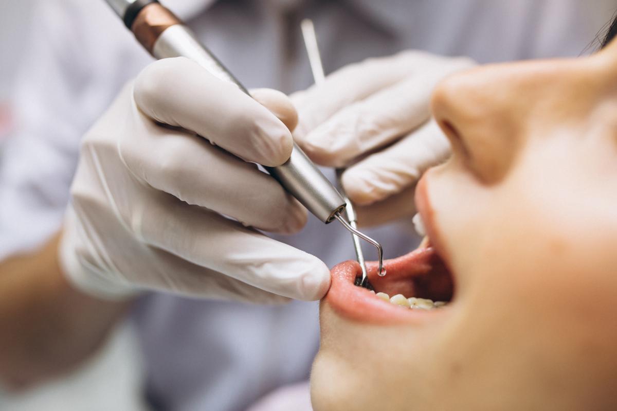 Check Up odontoiatrico