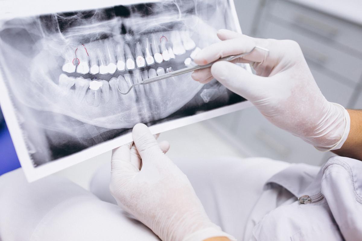 Mancanza denti. Conseguenze per la salute